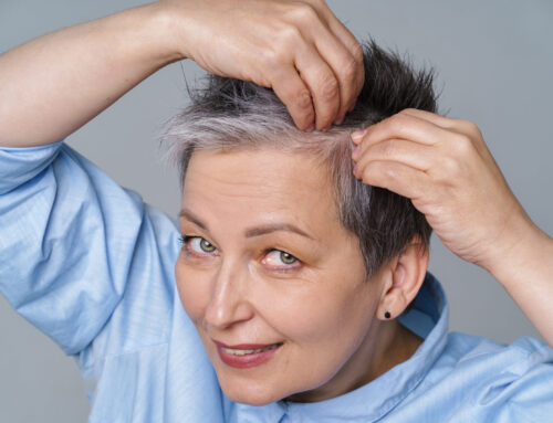 Minoxidil: tu aliado contra la alopecia